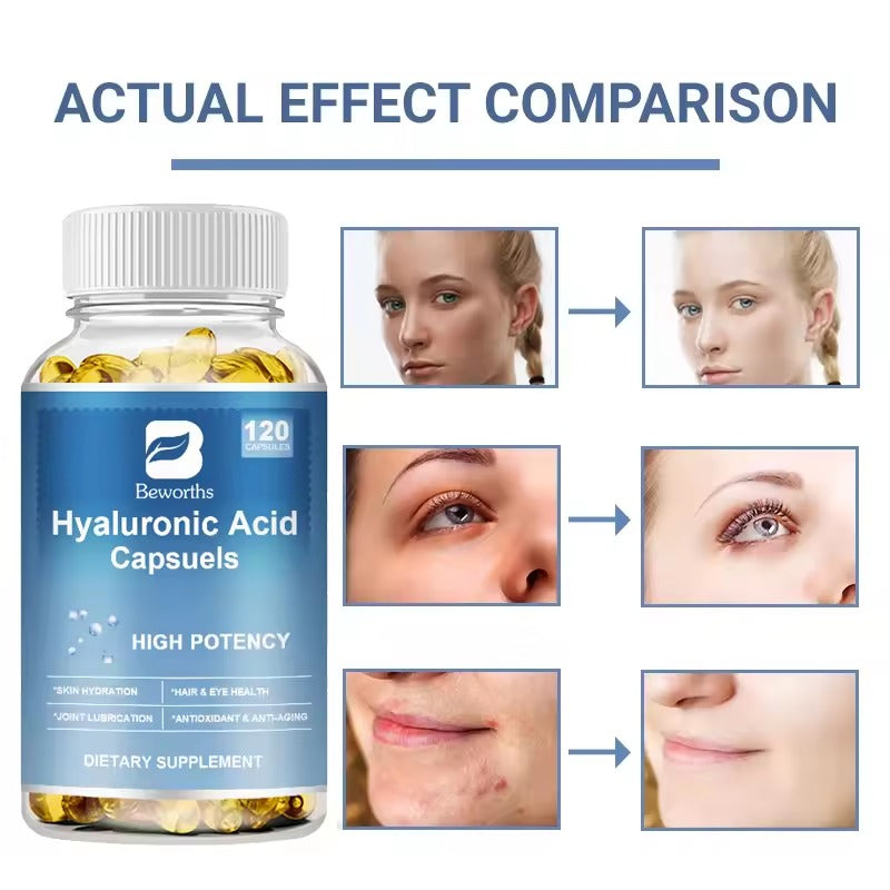BEWORTHS Hyaluronic Acid Capsules – Skin Hydration & Joint Flexibility Support