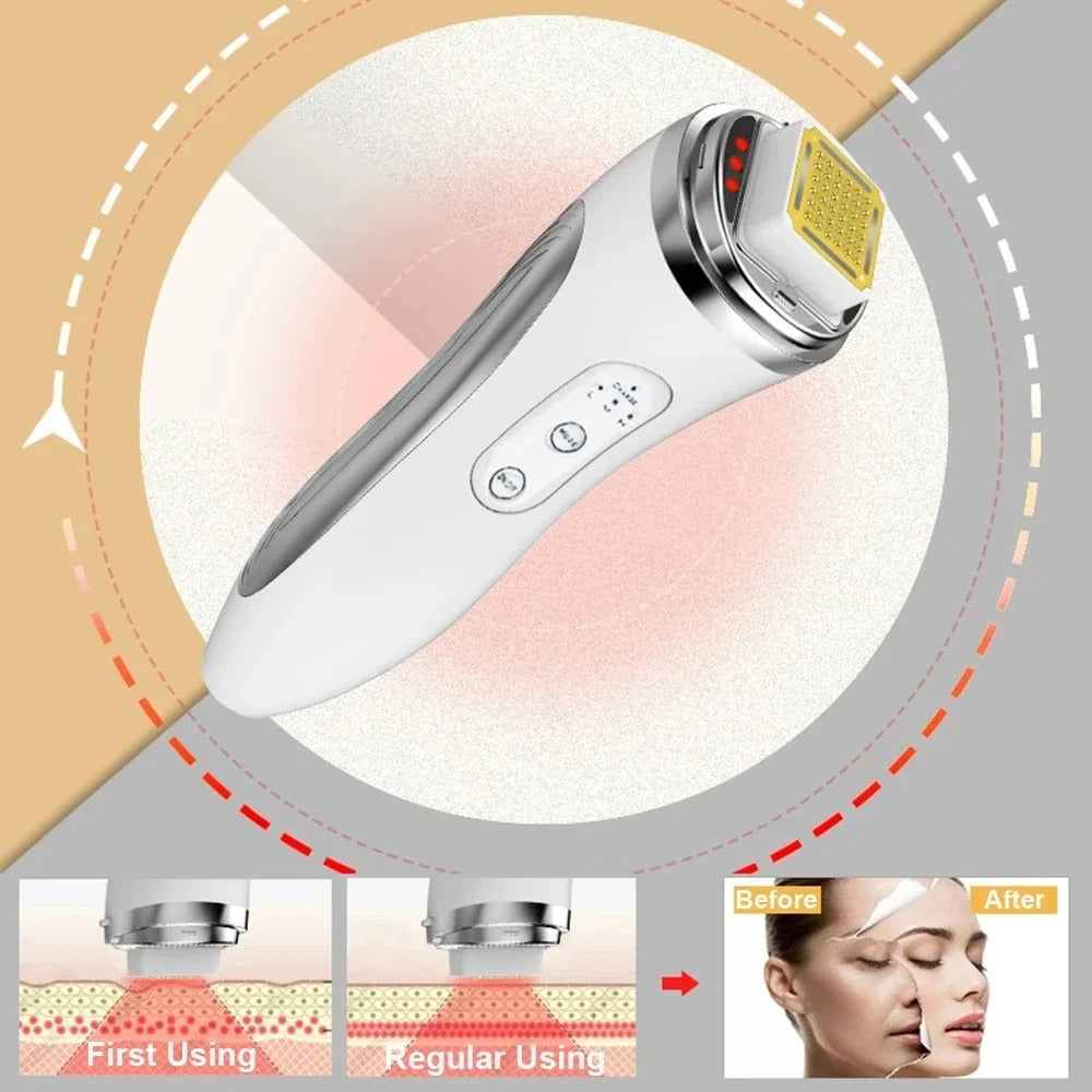 Radio Frequency Facial Lifting Machine – Dot Matrix Wrinkle Removal & Skin Tightening RF High Frequency Massager for Facial Care